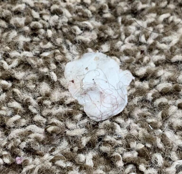 Kaugummi im Teppich? Wie Eiscreme das Problem in 2 Minuten löst